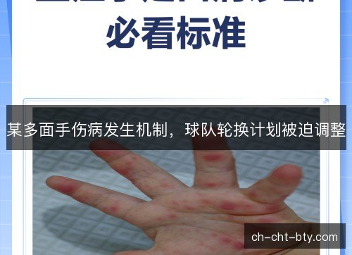 某多面手伤病发生机制，球队轮换计划被迫调整